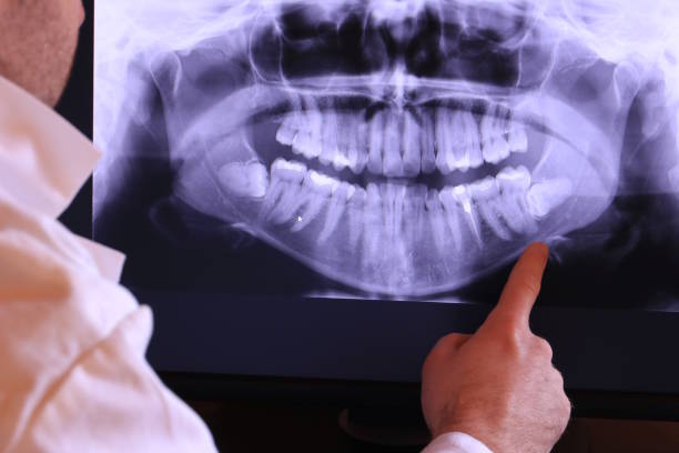 Best Emergency Dentist for Special Needs Patients in Searingtown, NY