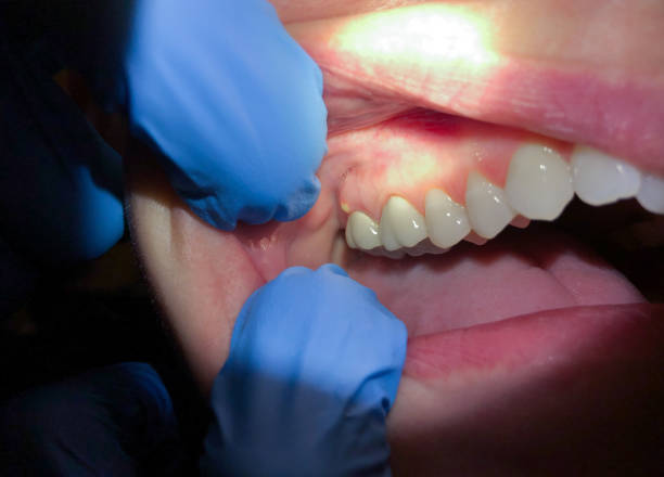 Best Emergency Cosmetic Dentistry in Searingtown, NY
